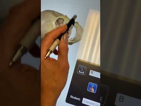 Anatomage Table: How to Use Quiz Mode