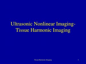 Ultrasonic Nonlinear Imaging- Tissue Harmonic Imaging - SlideServe