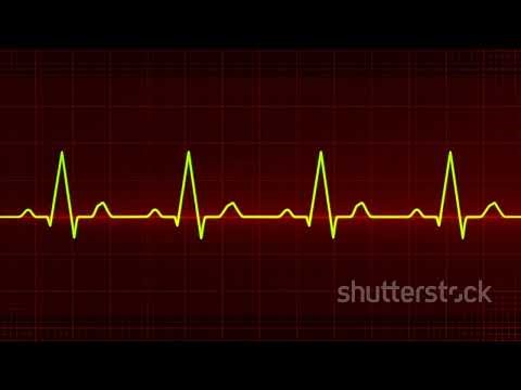 Master Heart Sounds in Minutes