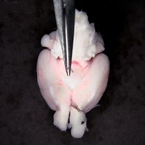 Cerebral Endothelial Tube Preparation and Sig - JoVE Journal
