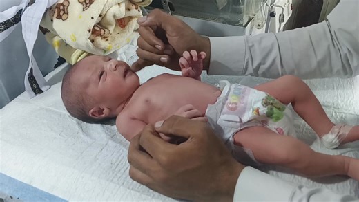 How to Remove Baby's Dress in the NICU | Gentle Care & Observation Guide #baby #babycute #babycare #viralvideo #nicubaby In this video, we show how to carefully remove the dress of a newborn baby in the NICU. Learn the proper steps to undress a fragile baby safely, maintain hygiene, provide gentle care, and continue essential observation during the process. This guide is helpful for NICU staff, caregivers, and parents learning about neonatal care. #NICUBabyCare #NewbornCare #NICUNursing #BabyDre