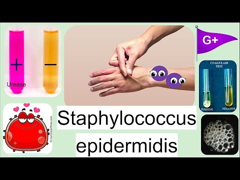 Staphylococcus epidermidis Bacteria: Everything you need to know