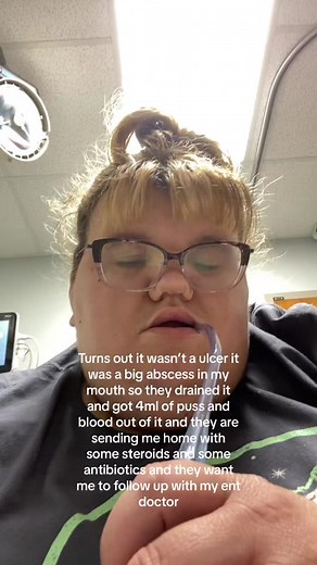 Leslie (@ipostaboutmyex)’s video of abscess