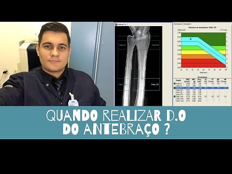 When should forearm densitometry be performed?