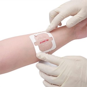 [Hot Item] Longmed Emergency Wound Closures Without Stitches Adhesive Bandages for Wound Care & First Aid