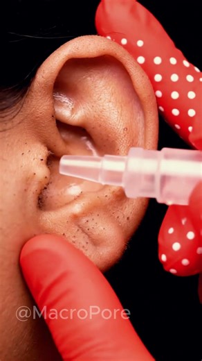 THIS EAR CLEANING IS ADDICTIVE 👀