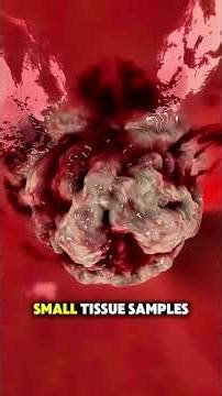 What Happen in Bronchoscopy || 3d animation #animation #doctors #shorts #learn #ytshorts