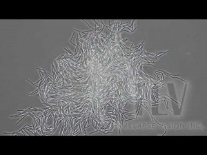 Clostridium perfringens -ウエルシュ菌-