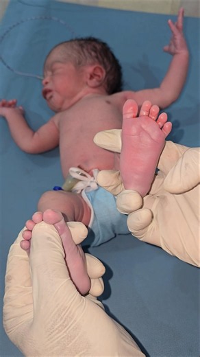 😱 Newborn Babinski Test❤️👣#shorts #youtubeshorts #nicucare #babycare #BabinskiReflex #newborn