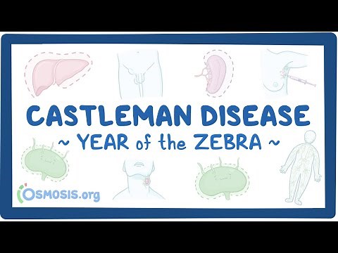 Castleman disease (Year of the Zebra)