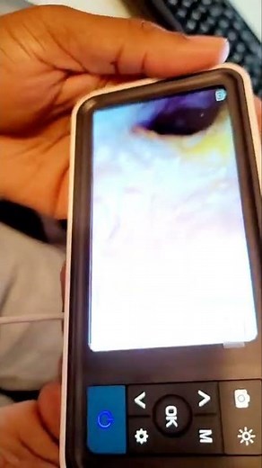 Anykit MS450-NTE digital otoscope with 4.5" screen