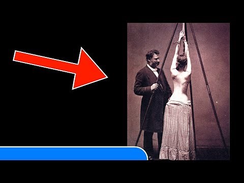 25 VINTAGE MEDICAL PHOTOS That Show How Patients Were Treated Before