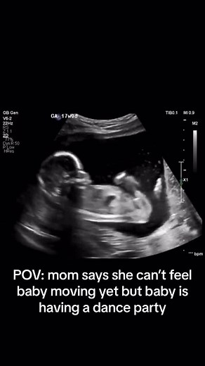 Can’t feel your baby moving yet? *DON’T PANIC* there are so many things that affect when you’ll feel movement such as 🌟how many weeks you are 🌟if you have an anterior placenta 🌟the position of your uterus 🌟position of your baby 🌟mom having lots of gas 🌟being overweight can all contribute to feeling movements later. Generally moms report feeling movements between 16-24 weeks (it’s such a wide range because we’re all different!). So if you don’t feel your little one moving just yet, relax an