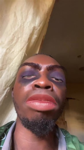 These lips are juicy ##lips #funny #fyp