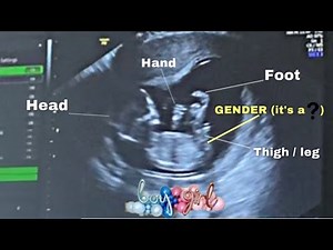 13 WEEK ULTRASOUND & GENDER REVEAL | it’s a..