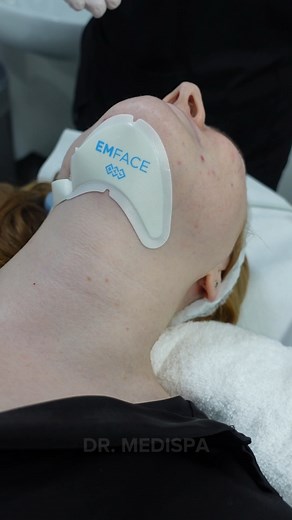 Say goodbye to your double chin with Emface Submentum | Dr. Medispa