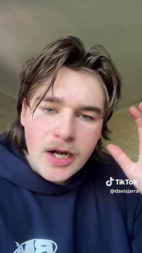 Australian Breakdancer Olympics: Kangaroo Dance at the Olympics