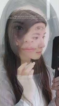 Thử thách cải thiện ngoại hình cho khách hàng tại Pucharm Phần 3 #phongkhamthammy #lamdep