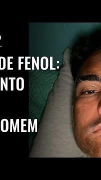 Entenda o que é peeling de fenol, procedimento estético que matou jovem de 27 anos