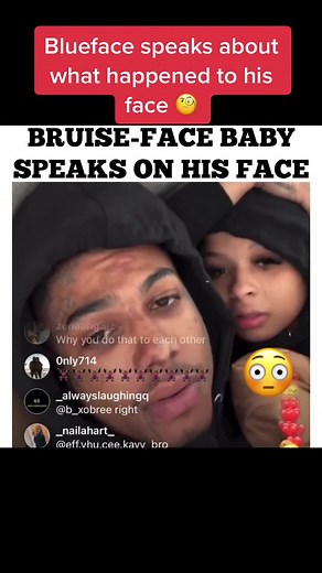 Blueface Opens Up About His Facial Injury