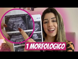 First Trimester Morphology Scan | 13 weeks and 6 days