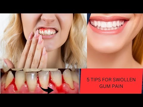 5 Tips for treating swollen gum pain / Home remedies for gum pain