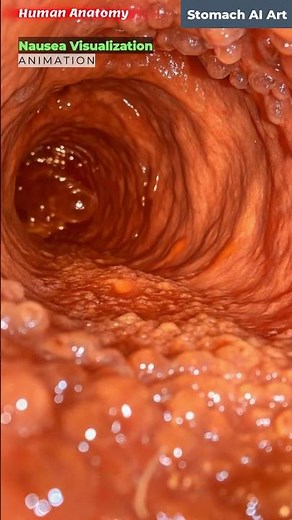 Illustration of Nausea and Stomach Animation | Stomach AI Art | 03