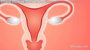 You must c C reate an account to continue watching