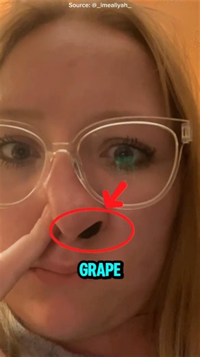 A Grape Got Stuck in Her Nose 😭🍇