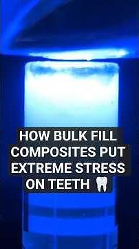 Composite Bulk-Fill vs. Oblique Layering: Why Technique Matters for Your teeth! 🦷