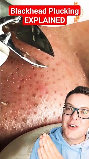 BLACKHEAD PLUCKING - The Best Blackhead Removal Yet #shorts