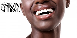 #SkinSchool: How to treat sun-damaged skin