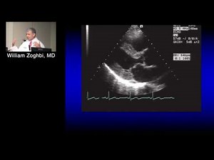 Principles of Echo Doppler (William Zoghbi, MD) September 13, 2016