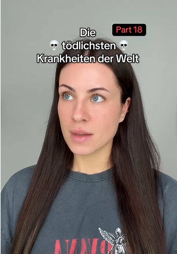 Typhus: Symptome und Stadien erklärt