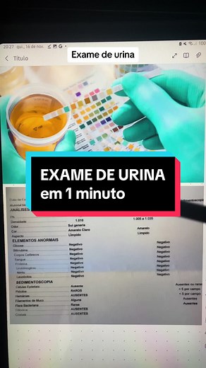 Exame de Urina: Interpretação e Resultados em 1 Minuto