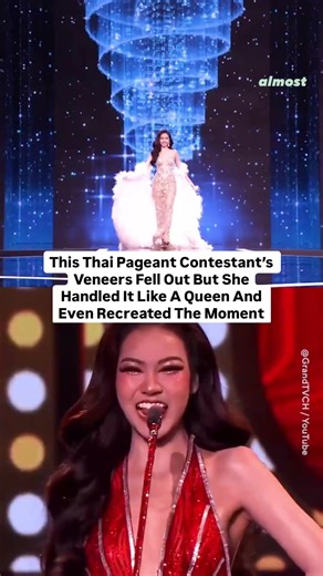 This Thai Pageant Contestant’s Veneers Fell Out But She Handled It Like A Queen