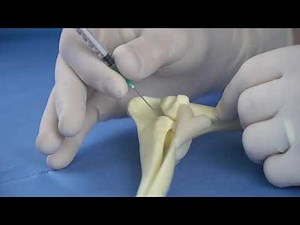 Elbow Injection Enso Discoveries