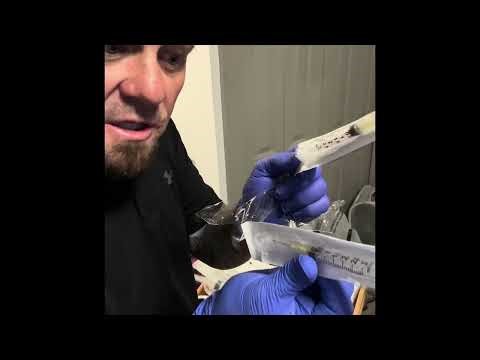 Setting up nocturnal home hemo