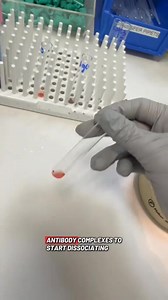 4.9K views · 82 reactions | Coombs test ❤️❤️ #LabLife #microbiology | Lab life | Facebook