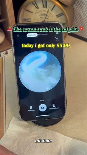 Effective Ear Wax Removal Tool with Camera Insights