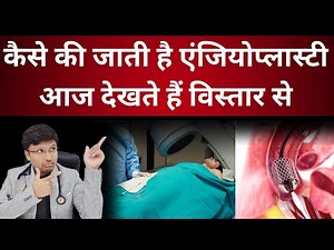 Angioplasty: a complete guide to how its done