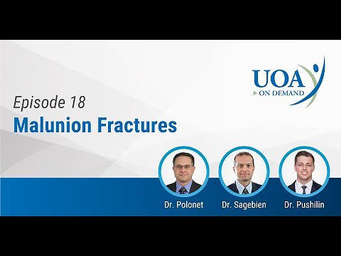 UOA On Demand: Malunion Fractures