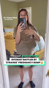 Internet baffled by strange pregnancy bump