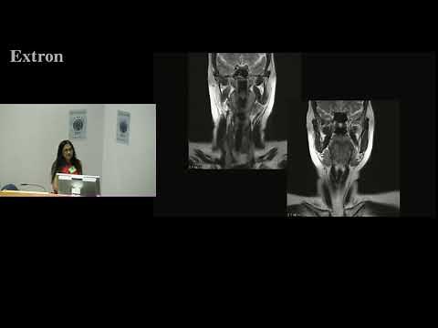 MRI of the Head & Neck