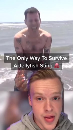 How To SURVIVE A Jellyfish STING! 🐙 (IG:Braydon.roy) #howto #survive #jellyfish #sting #survival #tips