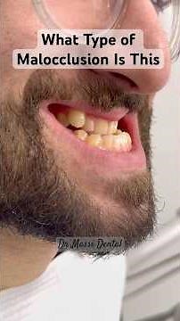 What Type of Malocclusion Is This?