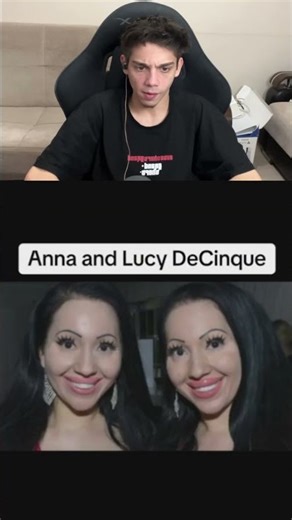 The Strangest Twins!