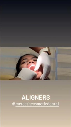 CLEAR ALIGNERS AT TRIVANDRUM | INVISIBLE ALIGNERS | MR. TEETH COSMETIC DENTAL| 9633405115