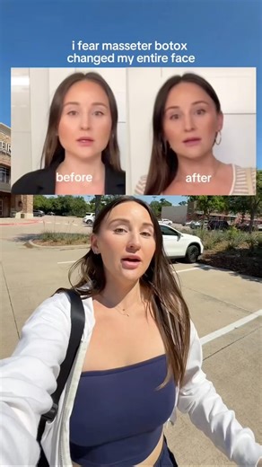 the before & after from last time is at the end and it’s WILD