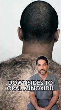 Doctor Explains the Downsides of Oral Minoxidil #minoxidil #hairlosstips